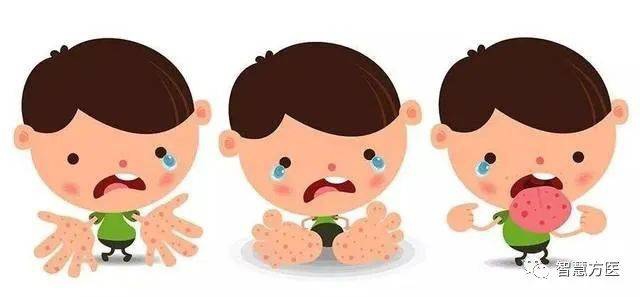 手足口病的预防